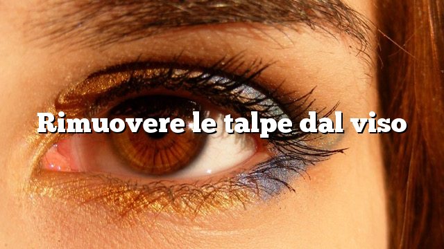 Rimuovere le talpe dal viso